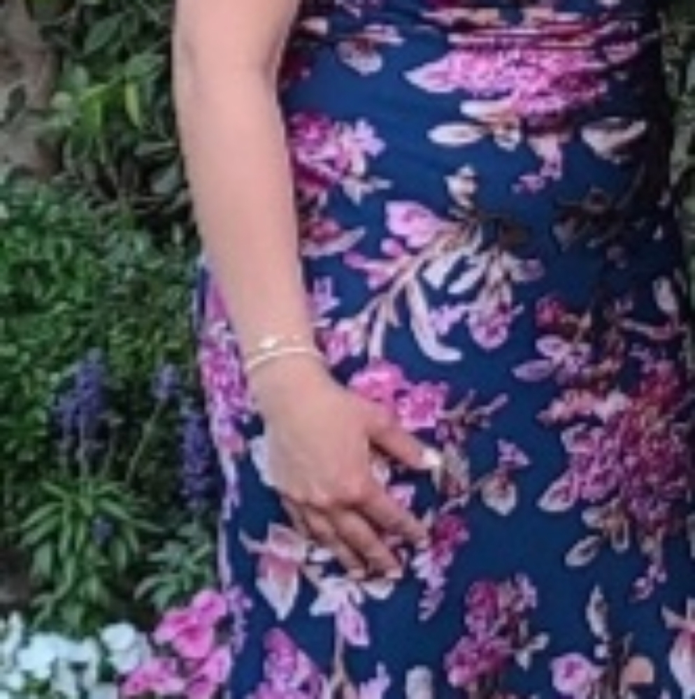 ASOS Design Floral Midi Dress - Picture 2 of 8